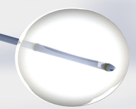 Angiographic Catheter Gallery Image 2 (Native 5:4)
